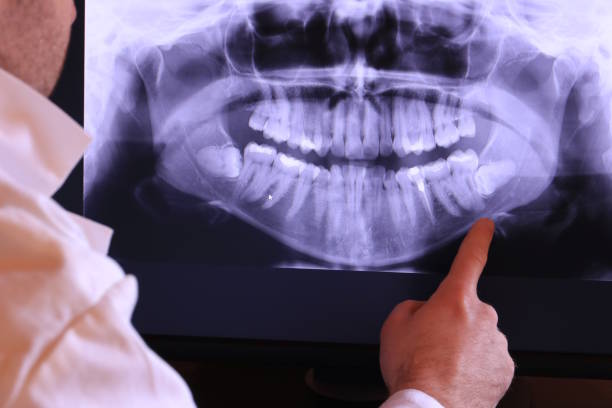 Best Emergency Treatment for Jaw Pain or Injury in Pitola, CA